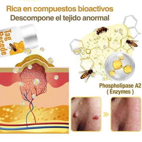 DERMABEE - Manchas en la piel