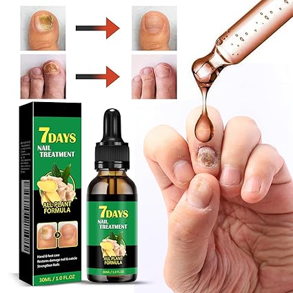 7 DAYS - ELIMINA HONGOS