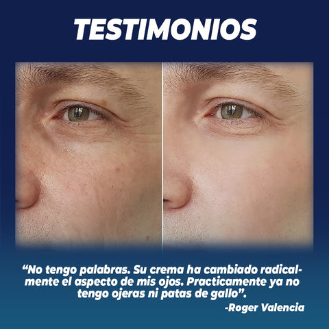 Image of OPENEYES™ CREMA DE OJOS PARA HOMBRES