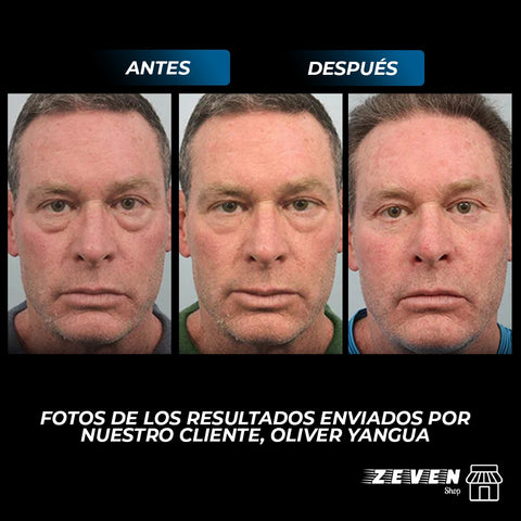 Image of OPENEYES™ CREMA DE OJOS PARA HOMBRES