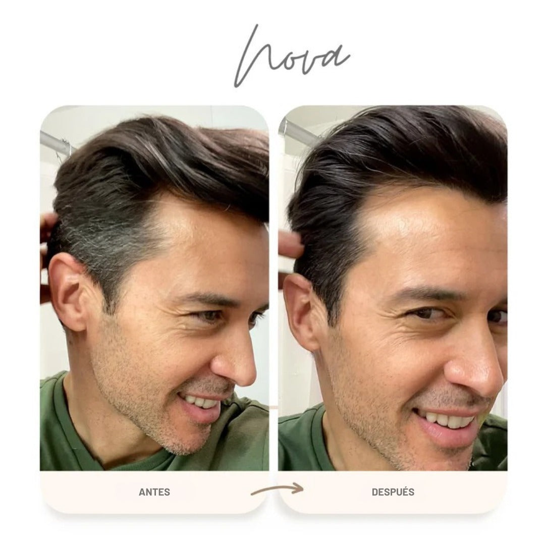 NEW HAIR RENEW