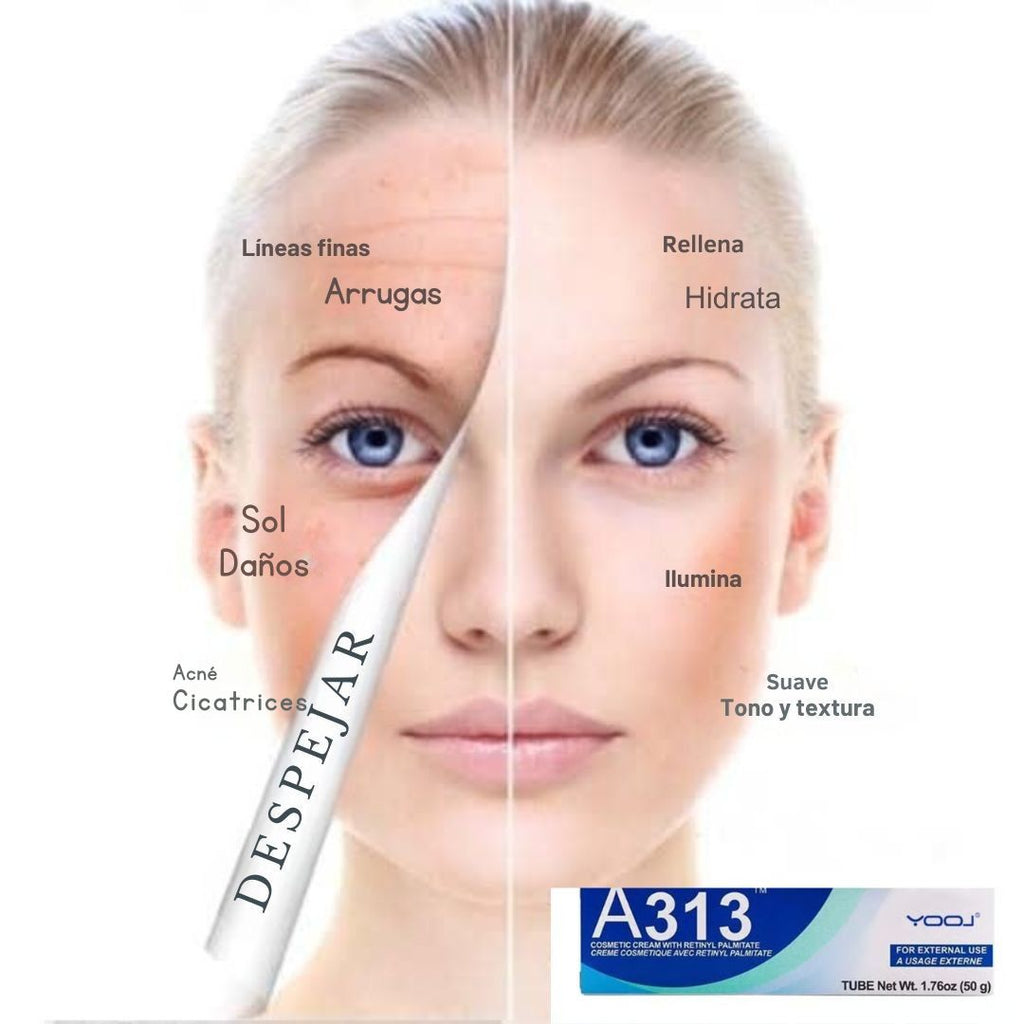 "A313: La Fórmula Perfecta de Retinol y Vitamina A para una Piel Radiante"